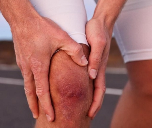 Операции на мениске коленного сустава при травмах Операции на мениске коленного сустава