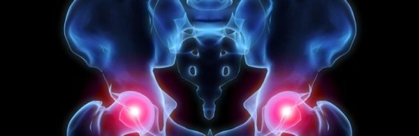 Диагностика трохантерита тазобедренного сустава Трохантерит тазобедренного сустава