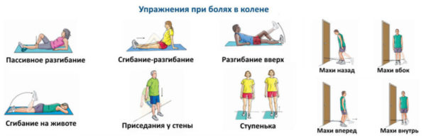 Артрит коленного сустава