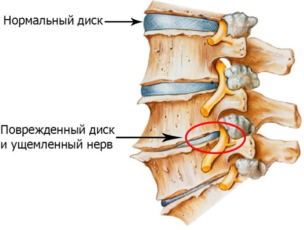 Мед для суставов