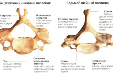 Вид пятого и седьмого позвонка шеи