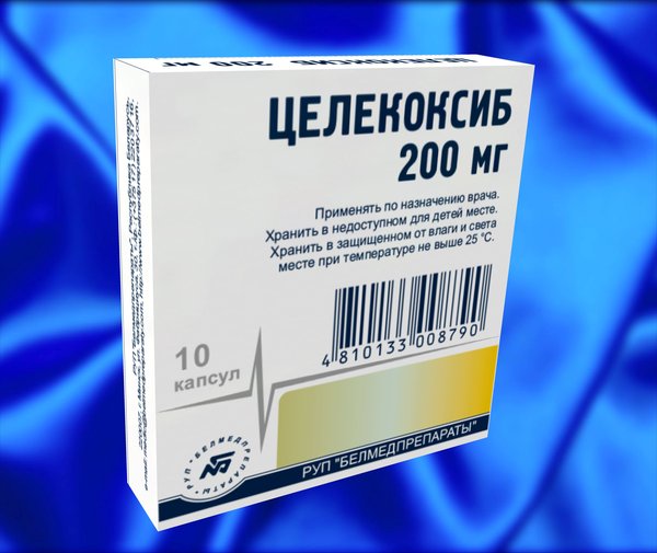 Радикулит поясничный