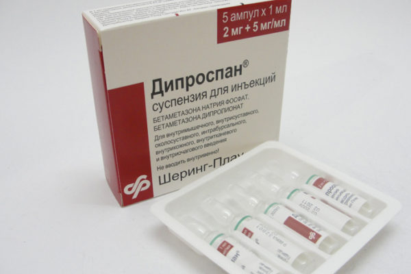 Уколы Дипроспана в сустав