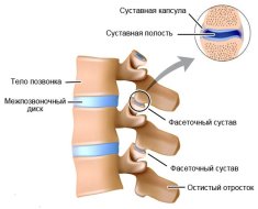 Вид фасеточного сустава