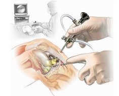 Процесс операции