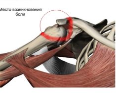 Синдром «столкновения»