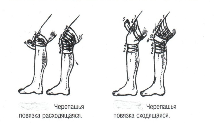 Эластичный бинт на колено