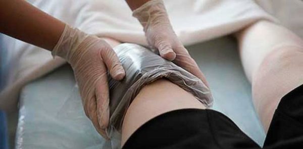 Опухло колено: лечебный компресс Опухло колено