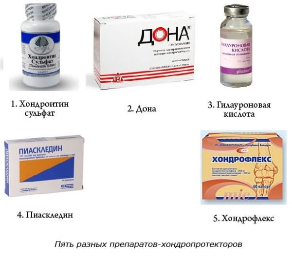 Артрит кисти