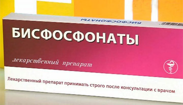 Остеопороз