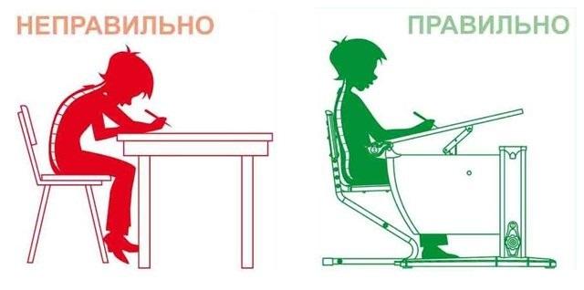 Сколиоз грудного отдела