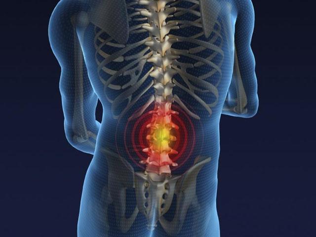 Особенности рентгена поясничного отдела Рентген поясничного отдела