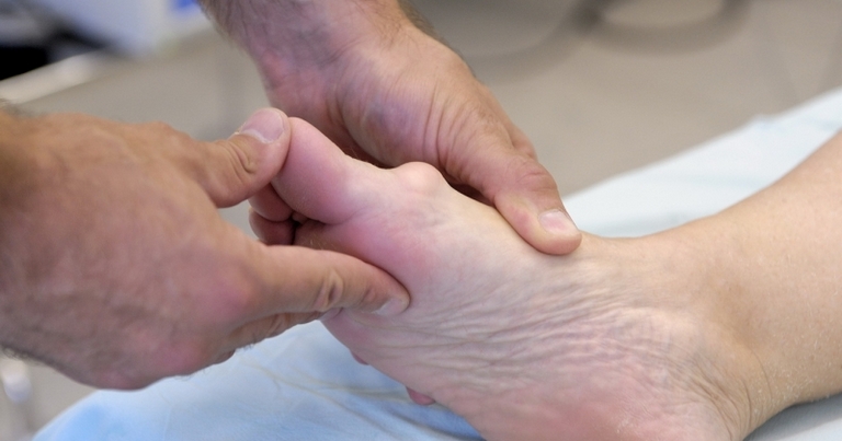 Шишки на суставах пальцев ног: диагностика Шишки на суставах пальцев ног