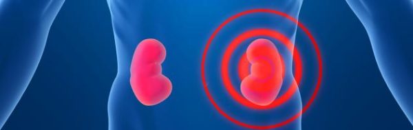 Боли в пояснице слева из-за проблем с почками Болит поясница в левой части