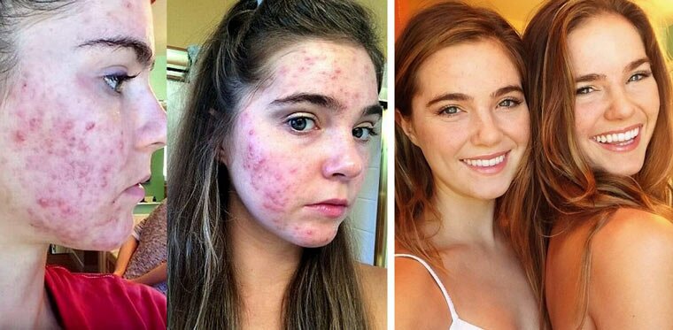 istorii veganov 11 istorii veganov 11