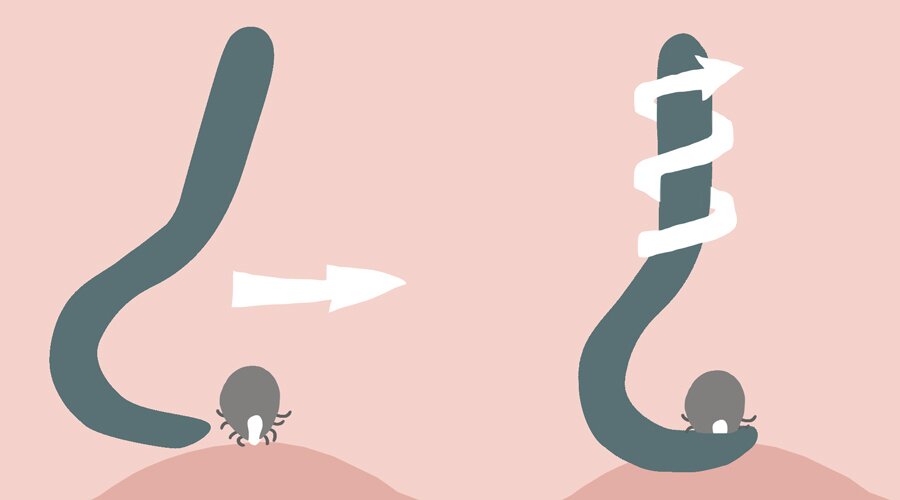 kak vytashhit kleshha